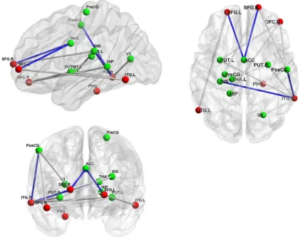 Table 3 Brain regions showing significant differences on fractional anisotropy between the alex group and the cont group