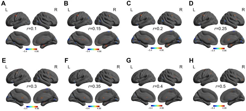 Figure 2 Within-group statistic maps of aD subjects (A) and healthy controls (B) in binarized degree centrality network using one-sample t-test.Note: Number (A) and voxel volume (B) of different Dc values in brain areas.Abbreviations: aD, alcohol dependent; Dc, degree centrality; l, left; r, right.