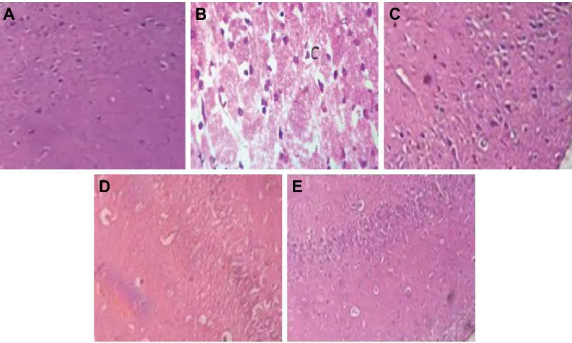 Figure 9 The expression of aPP, Abbreviations:β-secretases, γ-secretases, β-actin, and aβ1–42 compared to control.Notes: groups: a: Normal; B: aD; c: aD + baicalein (5 mg/kg); D: aD + baicalein (10 mg/kg); and e: aD + rivastigmine (0.3 mg/kg)