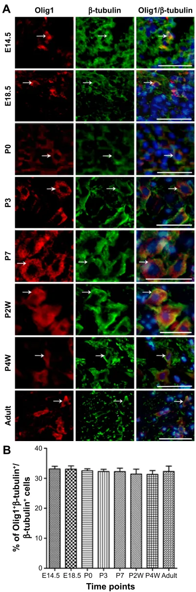 Figure 3 Double-label immunofluorescence staining of Olig1 expression in β-tubulin-postive neurons during rat spinal cord development.Notes: (A) coexpression of Olig1 and neuron markers β-tubulin from e14.5 to adult (indicated by white arrows; scale bars: 