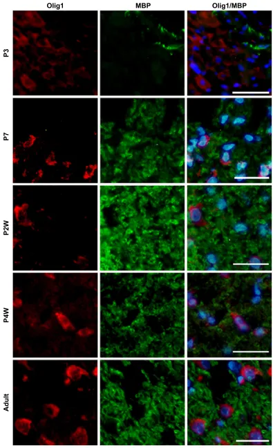 Figure 4 Developmental pattern of Olig1 expression in MBP-postive OLs of rat spinal cord using double-label immunofluorescence staining.Note: Ol markers of MBP were expressed from P3 to adulthood, without Olig1 coexpression (scale bars: 100 μm).Abbreviations: Olig1, oligodendrocyte lineage gene 1; MBP, myelin basic protein; Ol, oligodendrocyte; P, postnatal days; w, weeks.