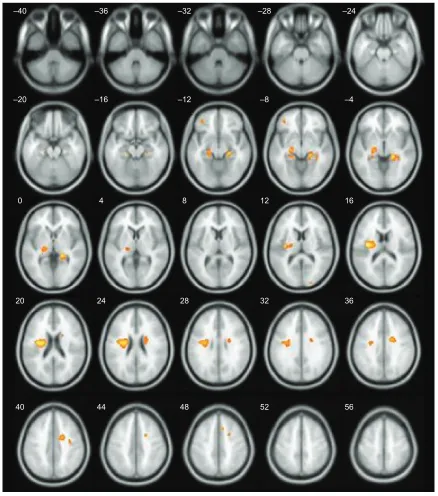 Table 7 sex-related white matter changes between young and old persons by voxel-based morphometry