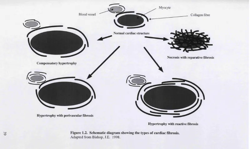 Figure 1.2. Schematic diagram showing the types of cardiac fibrosis.