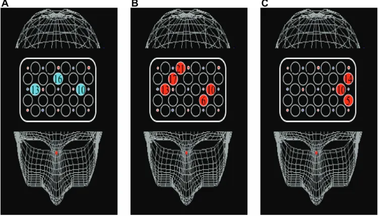 Figure 5 Cortical distribution of significant correlations between activation and performance