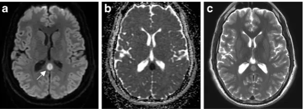 Fig. 8 Herpes simplex virus encephalopathy. Seventy-one-year-old manwith fever and encephalopathy