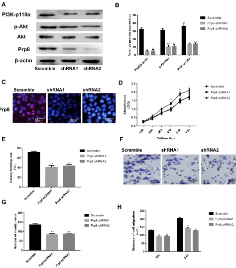 Figure 3 Loss of Prp8 has an inhibitory effect on cell viability and metastasis in HCC cells