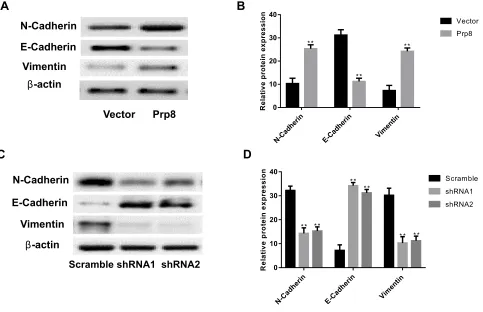 Figure 4 Prp8 activates EMT in HCC. (and Vimentin in Hep3B cells. (A) Prp8 regulated the expression levels of E-cadherin, N-cadherin and Vimentin in LX-2 cells