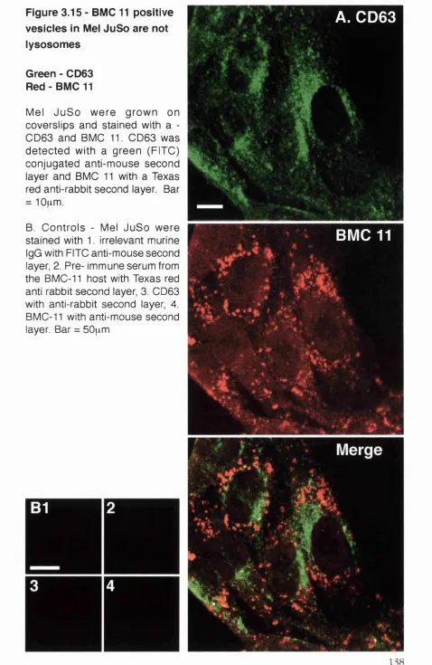 Figure 3.15 - BMC 11 positive 