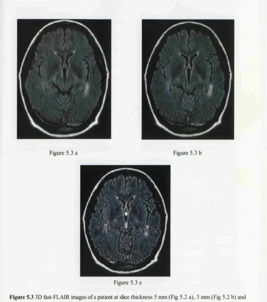 Figure 5.3 a