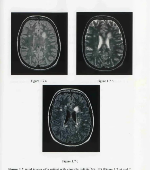 Figure 1.7 a