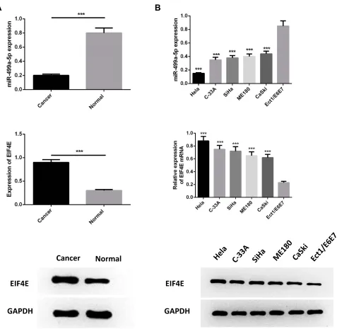 Figure 1 MiR-499a-5p was downregulated while eIF4E was upregulated in CC tissues and cell lines