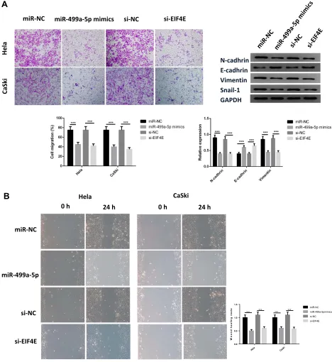 Figure 3 Overexpression of miR-499a-5p or eIF4E knockdown inhibited CC cell invasion and migration