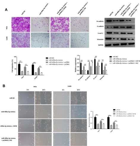 Figure 6 eIF4E overexpression reversed the effect of miR-499a-5p on invasion and migration of CC cell
