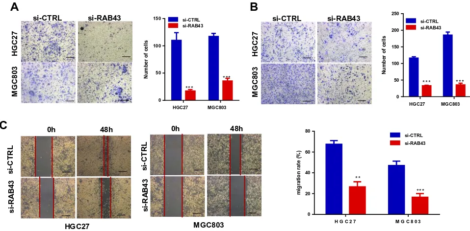 Figure 3 RAB43 downregulation attenuates GC cell proliferation and metastasis in vivo and in vitro