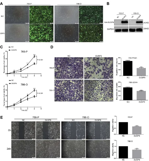 Figure 2 DUSP9 inhibits ccRCC cell proliferation and migration in vitro. (overexpression of DUSP9 in 769-P and 786-O cells