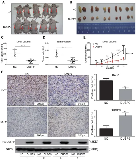 Figure 3 DUSP9 inhibits ccRCC tumor growth in vivo. (tumor volumes and tumor weights of DUSP9 overexpressing OS-RC-2 group were signitumors of the DUSP9 overexpressing group and NC group were dissected to determine their volumes and weights, and then analy