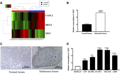 Figure 1 XIST level in melanoma tissues and cell lines.Notes: (A) Representative microarray analysis of XIST in melanoma tissue tissues and normal tissues (red denotes high relative expression and blue denotes low relativeexpression)