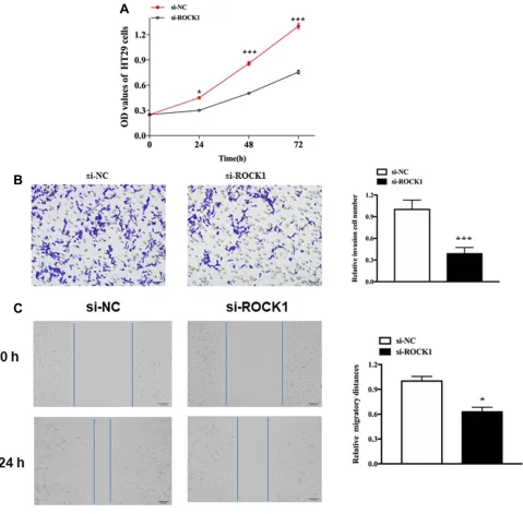 Figure 5 The role of ROCK1 in cellular function.migration in HS-1 cells after transfection with si-ROCK1 or si-NC