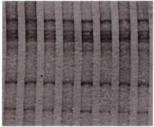 Figure 3.3 SSCP analysis of the human CEPH families controls. Samples were electrophoresed on a 10%T, T exon 1 coding sequence in 1.5%C polyacrylamide gel in 0.5x TBE at 4°C for 3.5 hours at 300 Volts.