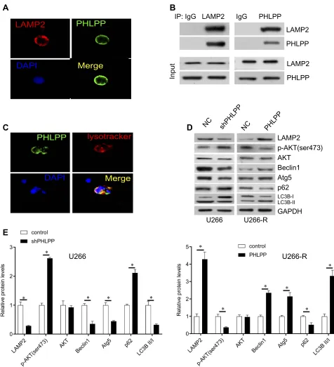 Figure 3 PHLPP positively regulates LAMP2 expression. (U266 cells. (loaded with lysotracker-Red DND-99 for 30 mins at 37°C