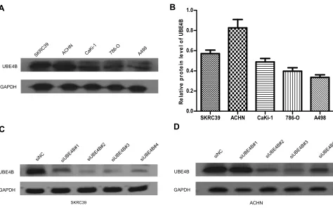 Figure 1 Expression of UBE4B mRNA and protein in human ccRCC surgical specimens was evaluated by RT-qPCR and Western blotting