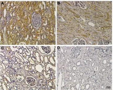 Figure 3 Representative immunohistochemical images of different staining intensity in ccRCC and surrounding non-tumor tissues