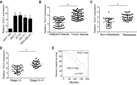 Figure 1 The expression of lncRNA HULC is higher in breast cancer tissues and cell lines