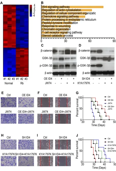 Figure 5 ID4 regulates the metastasis of retinoblastoma through the Wnt/and the corresponding normal tissues