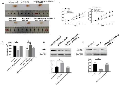 Figure 9 Roles of NEAT2/miRNA-22-3p/AKT2 axis in vivo study. (expression of AKT2 in HCC tissues of xenograft mice model treated with pLV-CMV-NEAT1, and combination of pLV-CMV-NEAT1 and miRNA-22-3p mimics