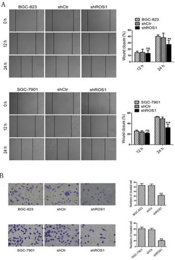 Figure 4 (A) ROS1 knockdown suppresses migration of gastric cancer cells. Migration abilities of gastric cancer cells transfected with shRNA were determined by wound healingassay