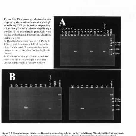 Figure 3.5. Pho.sphorimager (Molecular Dynamics) autoradiography of two lq21 sub-library Filters hybridized with separate 