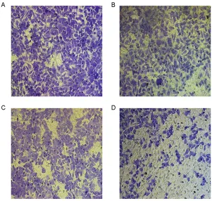 Figure 3 Cell scratch test of chitin oligosaccharide group, cisplatin group and combination group