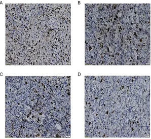 Figure 6 HE staining (40×10). Control group (focal necrosis, nuclear fragmentation and pyknosis, chromatin margination (A)