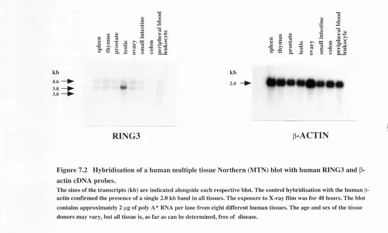 Figure 7.2 Hybridisation of a human multiple tissue Northern (MTN) hlot with human RING3 and p- 