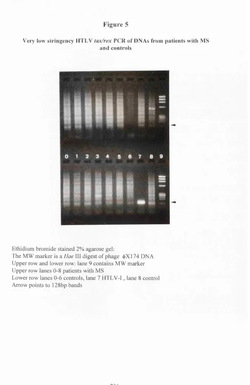 Very low stringency HTLV Figure 5tax/rex PCR of DNAs from patients with MS