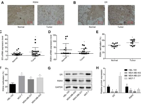 Figure 2 E2 decreased RSK4 expression and increased its methylation. After 48 h of treatments with 0, 10, 50 or 100 nM E2, MCF-7 cells were collected to the followingassays