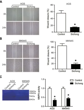 Figure 3 Sichong formula treatment inhibited the wound healing of human gastric cancer cells