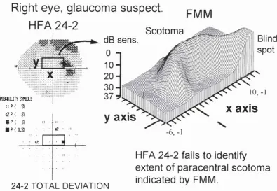 Figure 6.2b shows a Humphrey 30-2 greyscale and statpac2 total deviation plot, and adjacent FMMs, 