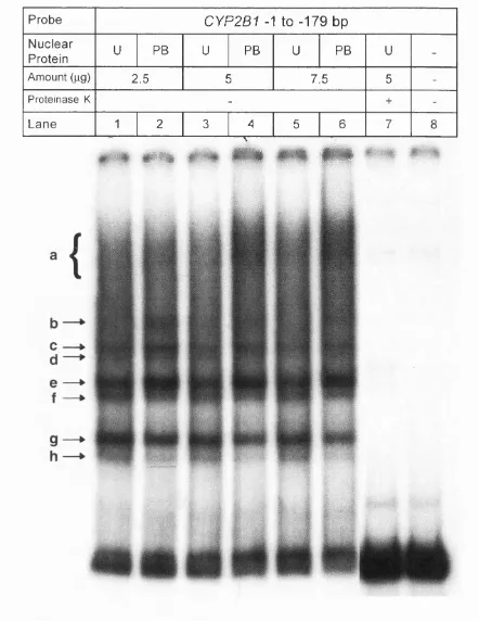 Fig. 3.1.4 Gel shift analysis of the CYP2B1-179 bp. lanes 1,3 and 5) or PB-treated rats were used (lanes 2, 4 and 6)