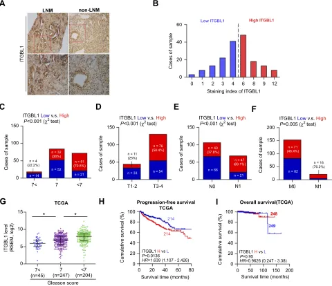 Figure 2 Overexpression of ITGBL1 is associated with lymph node metastasis of PCa. (A) Representative images of ITGBL1 expression in PCa tissues with lymph nodemetastasis and PCa tissues without lymph node metastasis via immunohistochemistry (IHC)