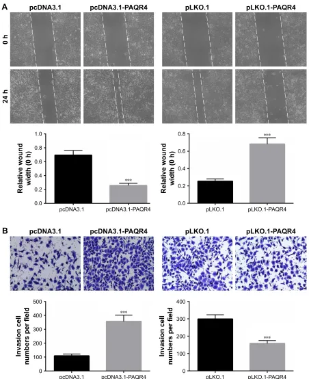 Figure 3 PaQr4 promotes cell migration and invasion. Notes: (A) cell migration was evaluated by wound healing assays after overexpression or knockdown of PaQr4