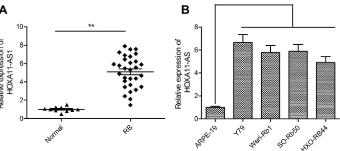 Figure 1 HOXA11-AS was up-regulated in RB tissues and cell lines. (A) The relative expression levels of HOXA11-AS was examined in 30 RB tissues and 10 normal retinaRB44) and human retinal epithelial cells ARPE-19 by using qRT-PCR analysis