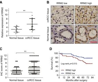 Figure 1 RRM2 is upregulated in ccRCC and predicts poor prognosis.Abbreviations: (A) The mRNA level of RRM2 in tissues from 10 cases of ccRCC and the correspondingnormal renal tissues was examined using RT-qPCR analysis