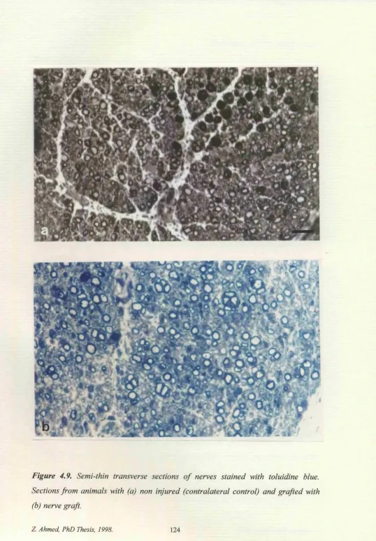 Figure 4,9, Semi-thin transverse sections of nerves stained with toluidine blue. 