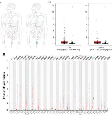 Figure S1 The expression of acTl8 gene and protein was determined by big data analysis.Notes: (A) The median expression of acTl8 in tumor and normal samples in bodymap in log2(TPM +1) scale pattern