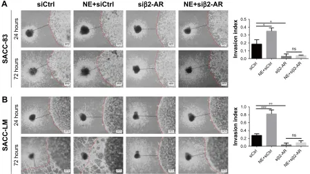 Figure 7 β2-ar mediated ne-induced Pni by sacc cells.Notes: (A, B) Drg coculture models comparing the Pni abilities of sacc-83 and sacc-lM cells after transfection with β2-ar sirna for 48 hours