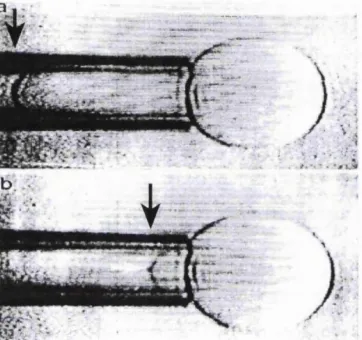 Figure 1.3: membrane area when experimenting with vesicles ethanolamine (40:60) as the temperature 20°C; (b) gel phase vesicle at 13°C showing 20% reduction in vesicle equal suction