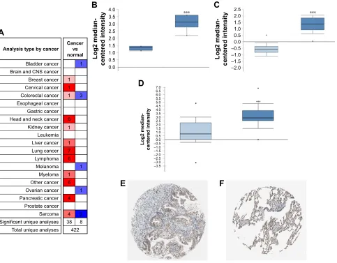 Figure 6 schematic of the difference between the expression of the TPBg gene in lung cancer cells.Notes: (A) scatter plots of differential expression of the TPBg gene in Tcga lung cancer tissues