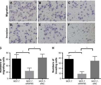 Figure 4 apoptosis rates.with siraP80 showed a higher percentage of apoptotic cells than wild-type McF-7 or McF-7-sinc.Abbreviation:Notes: apoptosis rate of wild-type McF-7 (A), McF-7-sinc (B), and McF-7-siraP80 (C) was assessed by the annexin V-FiTc-label