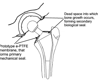 Figure 1.1. Schematic for Membrane Placement